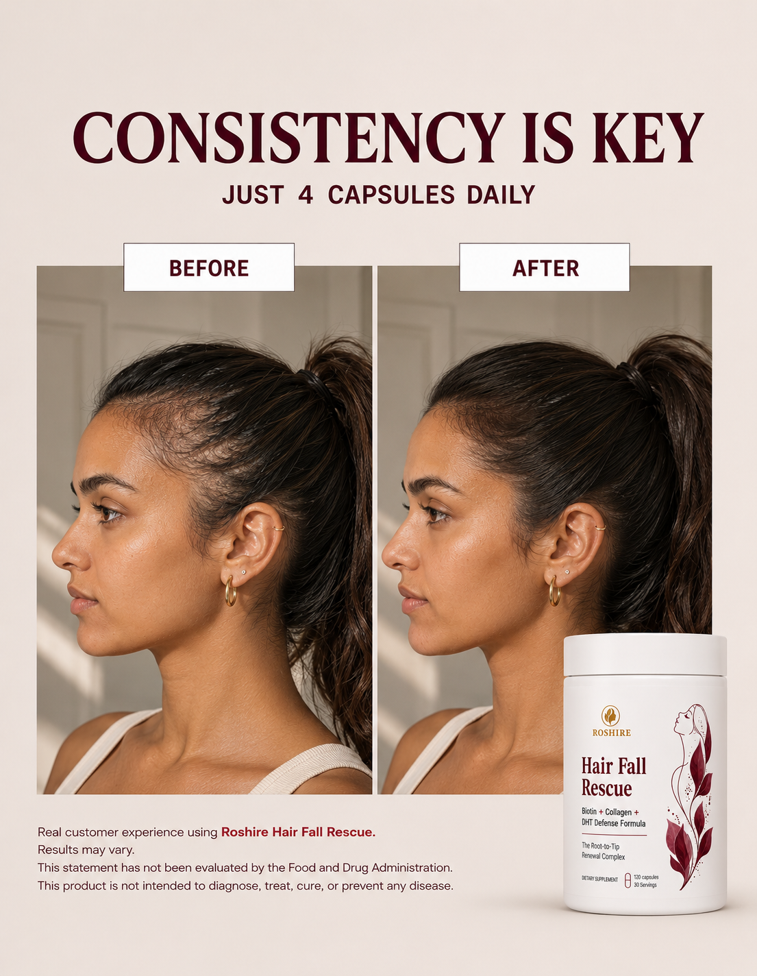 Roshire Hair Fall Rescue – Biotin + Collagen + DHT Defense Formula